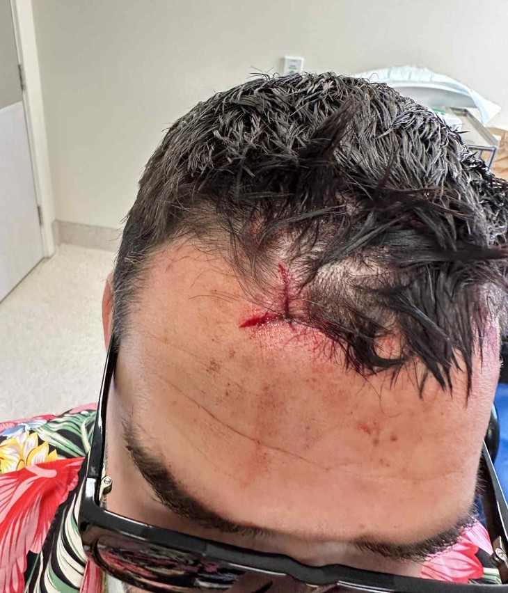 A close-up photo showing the wound on Grant Sweeney's forehead.