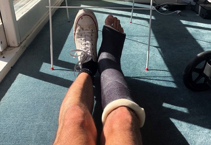 Liam Olson with his right ankle in a cast after surgery. 
